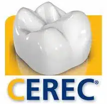 CEREC Dental Crown