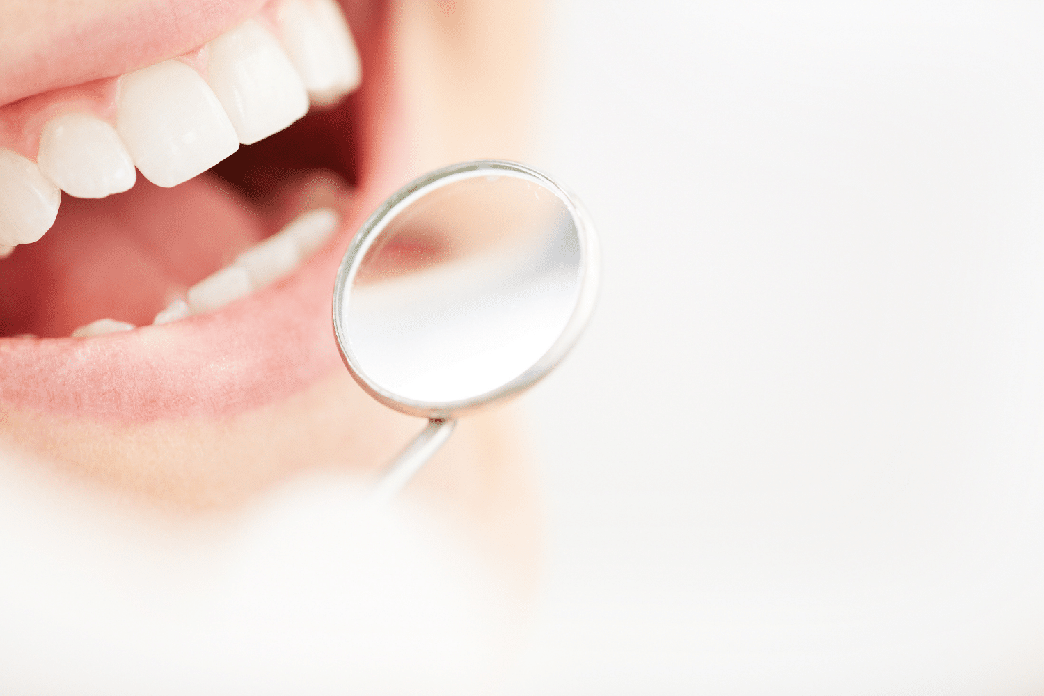 A mirror looking at the inside of a dental patient's mouth