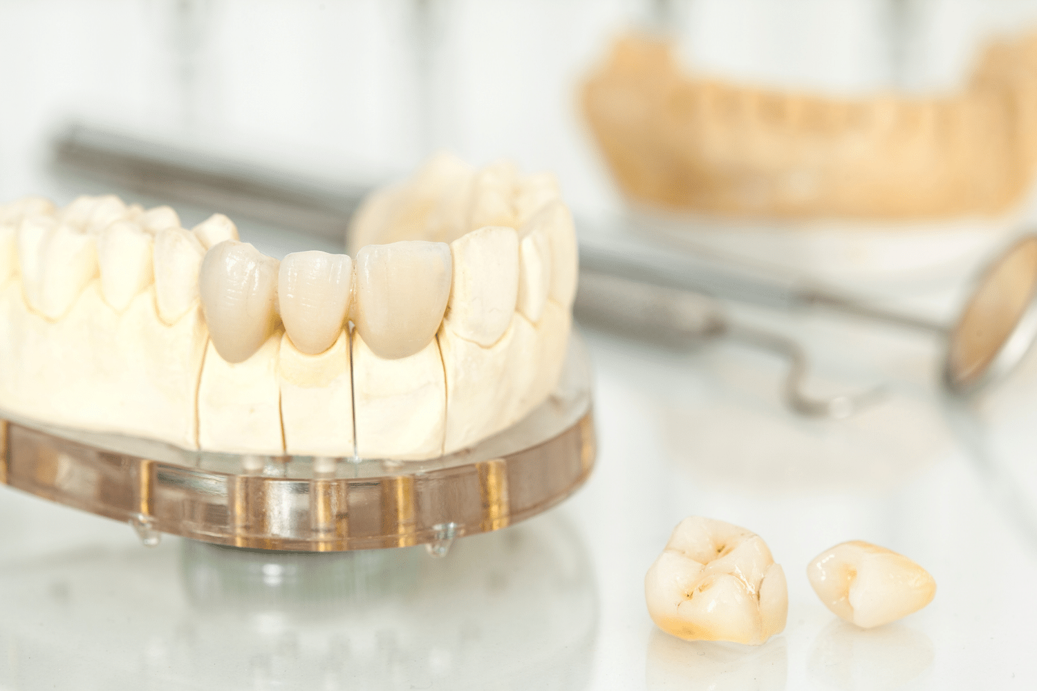 model of dental crowns