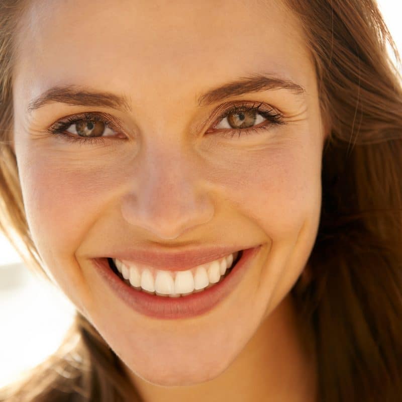 closeup of a young woman showing her beautiful smile makeover, dental veneers