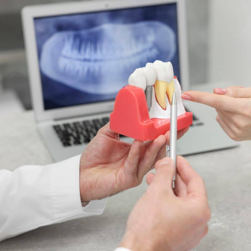 closeup of a dentist showing a dental implant model to a patient